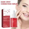 Hoygi Dark Spots Essence, Moisturizing And Brightening Essence For Dark Spots And Age Spots