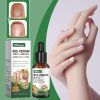 South Moon Nail Repair Solution Soft Nails Thick Nails Cleaning Care Nourishing Care Around The Nail