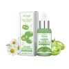 Hoygi Skin Care Repair Essence Hydrates And Moisturizes Non-Tight And Gentle Repair Skin Essence