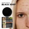 Jaysuing Facial Cleansing Soap Face Gentle Cleansing Back Acne Care Skin Bath Soap